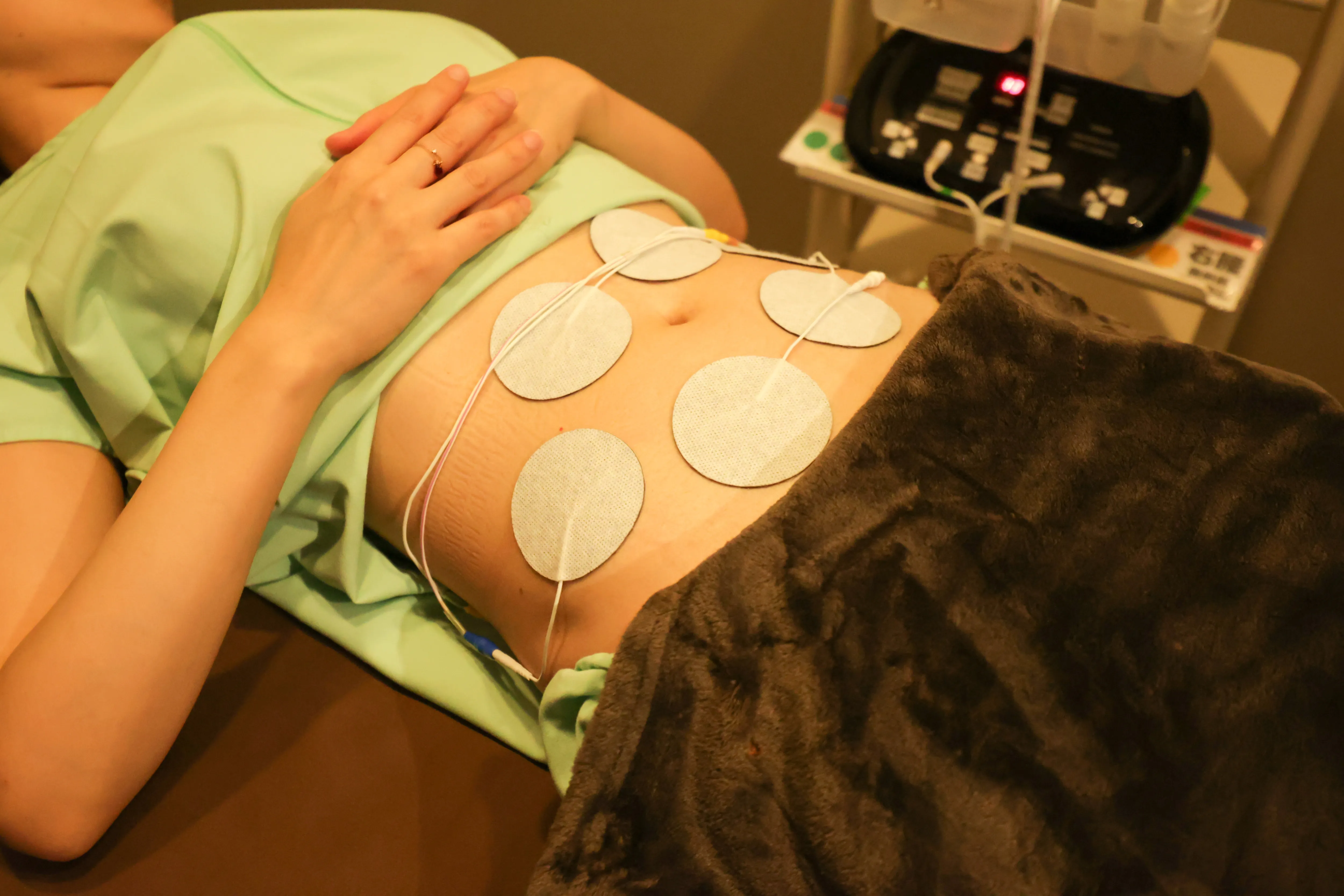 お腹に電極を貼られた女性の写真3